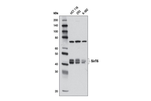 Western blot analysis of extracts from HCT 116, 293, and K-562 cells using SirT6 (D10A4) Rabbit mAb.