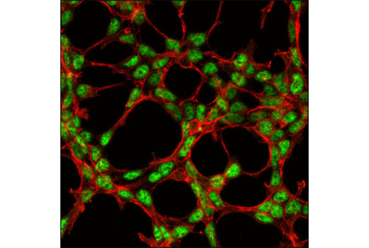 Confocal immunofluorescent analysis of 293 cells using SKAR α/β (D65E8) Rabbit mAb (green). Actin filaments were labeled with DY-554 phalloidin (red).