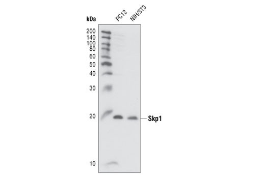 Western blot analysis of extracts from PC12 and NIH/3T3 cells, using Skp1 Antibody.