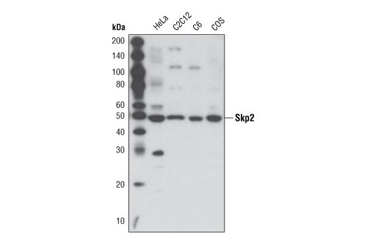 Western blot analysis of extracts from various cell lines using Skp2 (L70) Antibody.