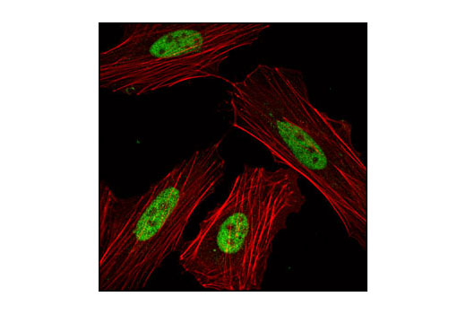 Confocal immunofluorescent analysis of HeLa cells using Skp2 (L70) Antibody (green). Actin filaments have been labeled with DY-554 phalloidin (red).