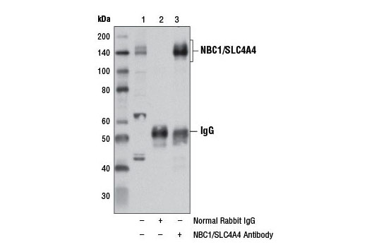 Immunoprecipitation of NBC1/SLC4A4 from LNCaP cell extracts, using Normal Rabbit IgG #2729 (lane 2) or NBC1/SLC4A4 Antibody (lane 3). Lane 1 is 10% input. Western blot analysis was performed using NBC1/SLC4A4 Antibody.