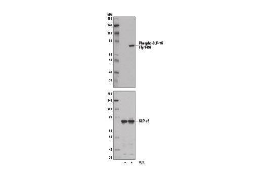 Western blot analysis of extracts from Jurkat cells, untreated (-) or H 2 O 2 -treated (11 mM, 1 min; +), using Phospho-SLP-76 (Tyr145) Antibody (upper) and SLP-76 Antibody #4958 (lower).