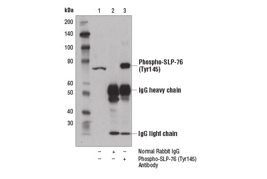 Immunoprecipitation of phospho-SLP-76 (Tyr145) from Jurkat cell extracts treated with H 2 O 2 (11 mM, 1 min) using Normal Rabbit IgG #2729 (lane 2) or Phospho-SLP-76 (Tyr145) Antibody (lane 3). Lane 1 is 10% input. Western blot analysis was performed using Phospho-SLP-76 (Tyr145) Antibody.