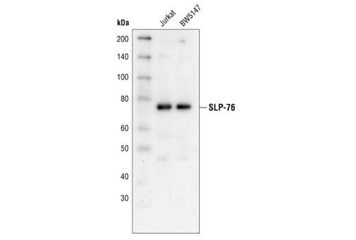 Western blot analysis of extracts from Jurkat and BW5147cells using SLP-76 Antibody.