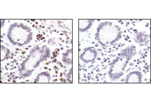 Immunohistochemical analysis of paraffin-embedded human colon using SLP-76 Antibody in the presence of control peptide (left) or antigen-specific peptide (right).