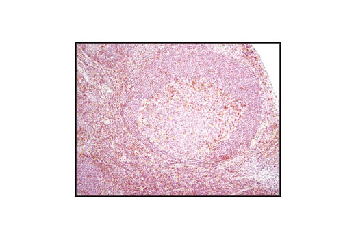 Immunohistochemical analysis of paraffin-embedded human tonsil using SLP-76 Antibody.