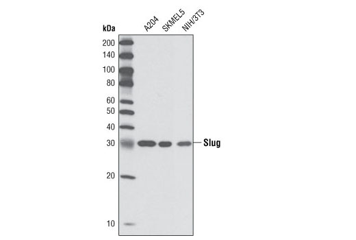 Western blot analysis of extracts from A204, SKMEL5, and NIH/3T3 cells using Slug (C19G7) Rabbit mAb.