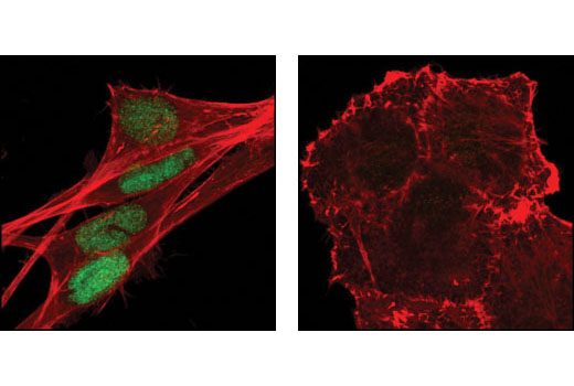 Confocal immunofluorescent analysis of A204 cells (left) and PANC-1 cells (right) using Slug (C19G7) Rabbit mAb (green). Actin filaments have been labeled with DY554 phalloidin (red).
