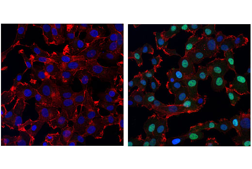 Confocal immunofluorescent analysis of HT-1080 cells, serum-starved (overnight; left) or serum-starved and treated with Human BMP2 #4697 (50 ng/ml, 30 min; right), using Phospho-Smad1 (Ser463/465)/ Smad5 (Ser463/465)/ Smad9 (Ser465/467) (D5B10) Rabbit mAb (green) and β-Actin (13E5) Rabbit mAb (Alexa Fluor ® 647 Conjugate) #8584 (red). Blue pseudocolor = Propidium Iodide (PI)/RNase Staining Solution #4087.