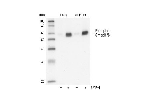 Western blot analysis of extracts from untreated or BMP-4-treated HeLa or NIH/3T3 cells using Phospho-Smad1/5 (Ser463/465) (41D10) Rabbit mAb.