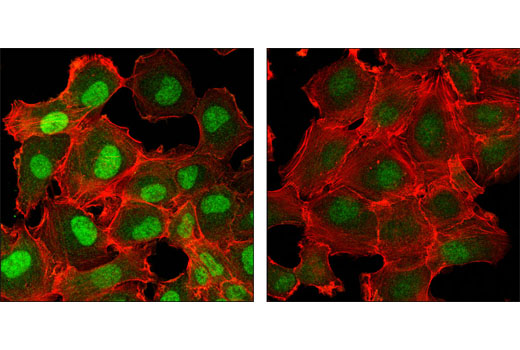 Confocal immunofluorescent analysis of HT-1080 cells, BMP-treated (left) and untreated (right), using Phospho-Smad5 (Ser463/Ser465) (41D10) Rabbit mAb (green). Actin filaments were labeled with DY-554 phalloidin (red).