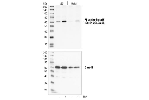 Western blot analysis of extracts from 293 and HeLa cells, untreated or TPA-treated (200 nM for 30 minutes) using Phospho-Smad2 (Ser245/250/255) Antibody (upper) or Smad2 Antibody (lower).