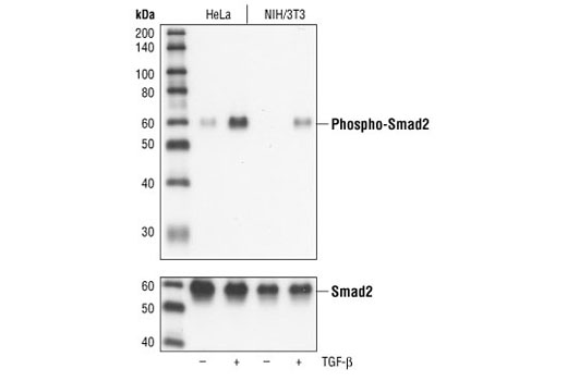 Western blot analysis of extracts from untreated or TGF-beta treated HeLa and NIH/3T3 cells, using Phospho-Smad2 (Ser465/467) (138D4) Rabbit mAb (upper), or Smad2 Antibody #3102 (lower).