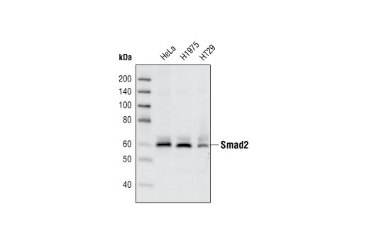 Western blot analysis of extracts from HeLa, H1975 and HT29 cell lines, using Smad2 (86F7) Rabbit mAb.