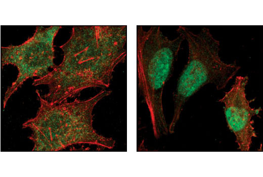 Confocal immunofluorescent analysis of HeLa cells, untreated (left) or TGF-β treated (right), using Smad2 (86F7) Rabbit mAb (green). Actin filaments have been labeled with Alexa Fluor® 555 phalloidin (red)