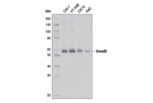 Western blot analysis of extracts from various cell lines using Smad5 (D4G2) Rabbit mAb.