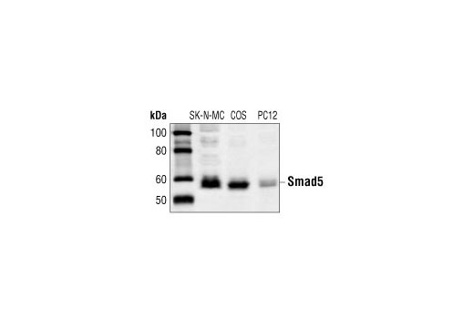 Western blot analysis of extracts from SK-N-MC, COS and PC12 cells, using Smad5 Antibody.
