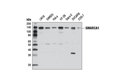 Western Blot anaylsis of extracts from various cell lines using SMARCA1 (D4Q7V) Rabbit mAb.
