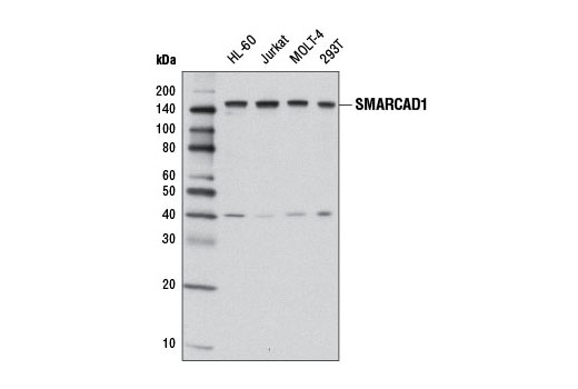 Western blot analysis of extracts from various cell lines using SMARCAD1 Antibody.