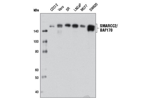 Western blot analysis of extracts from various cell lines using SMARCC2/BAF170 (D8O9V) Rabbit mAb.