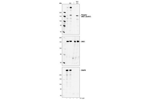 Western blot analysis of extracts from 293 and NIH/3T3 cells, untreated or UV-treated, using Phospho-SMC1 (Ser957) (5D11G5) Mouse Monoclonal Antibody (upper), SMC1 Antibody #4802 (middle), and DNA-PK Antibody #4602 (lower).