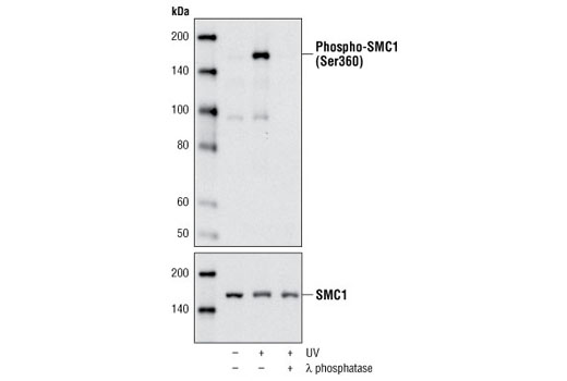 Western blot analysis of extracts from 293 cells, untreated or UV-treated (100 J/m 2 followed by 4 hour recovery) using Phospho-SMC1 (Ser360) Antibody (upper) or SMC1 Antibody #4802 (lower). Antibody phospho-specificity was determined by treating cell extracts with λ phosphatase.