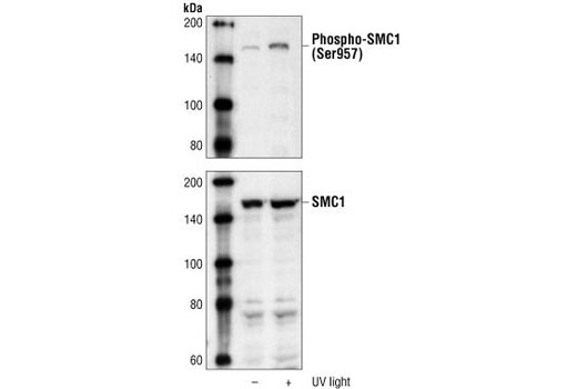 Western blot analysis of extracts from 293 cells, untreated or UV-treated, using Phospho-SMC1 (Ser957) Antibody #4801 (upper) or SMC1 Antibody (lower).