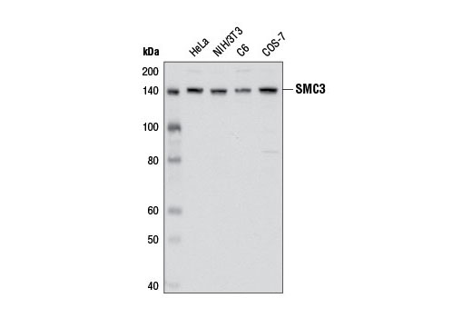 Western blot analysis of extracts from various cell lines using SMC3 (D47B5) Rabbit mAb.