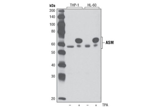 Western blot analysis of extracts from THP-1 and HL-60 cells, untreated (-) or treated overnight with TPA #9905 (+), using ASM Antibody.