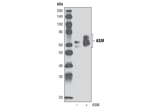 Western blot analysis of extracts from COS-7 cells, untransfected (-) or transfected with a human ASM construct (+), using ASM Antibody.