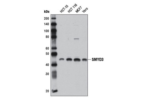 Western blot analysis of extracts from various cell lines using SMYD3 (D2Q4V) Rabbit mAb.