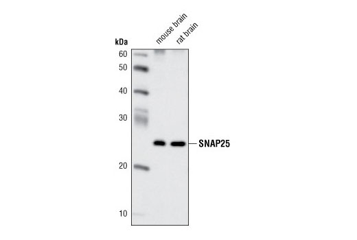 Western blot analysis of extracts from mouse and rat brain using SNAP25 (D110) Antibody.