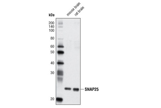 Western blot analysis of extracts from mouse and rat brain using SNAP25 (D7B4) Rabbit mAb.