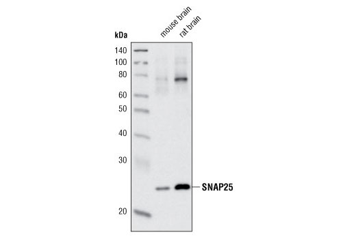 Western blot analysis of extracts from mouse and rat brain using SNAP25 (D9A12) Rabbit mAb.