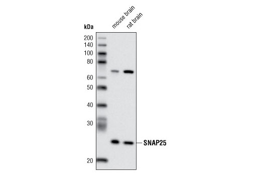 Western blot analysis of extracts from mouse and rat brain using SNAP25 (A195) Antibody.