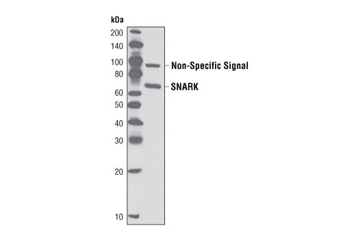 Western blot analysis of extracts from the mouse tibialis anterior (TA) muscle using SNARK/NUAK2 Antibody.