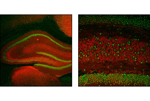 Confocal immunofluorescence images of rat hippocampus labeled with α/β-Synuclein (Syn205) Mouse mAb (red) and CREB (48H2) Rabbit mAb #9197 (green).