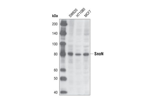 Western blot analysis of extracts from SW620, HT-1080 and MCF-7 cells using SnoN Antibody.