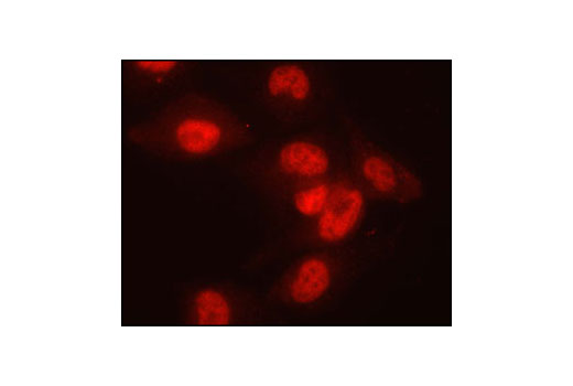 Immunofluorescent analysis of A-204 cells showing nuclear staining, using SnoN Antibody.