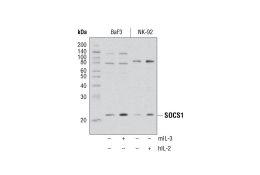 Western blot analysis of extracts from BaF3 cells starved of mouse IL-3 and serum overnight, untreated (-) or mouse IL-3-treated (10 ng/ml, 6 hr; +) and NK-92 cells starved of human IL-2 and serum overnight, untreated (-) or human IL-2-treated (10 ng/ml, 6 hr; +), using SOCS1 (A156) Antibody.