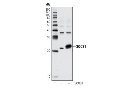 Western blot analysis of extracts from COS-7 cells, untransfected (-) or transfected with a construct overexpressing human SOCS1 (+), using SOCS1 (A156) Antibody.