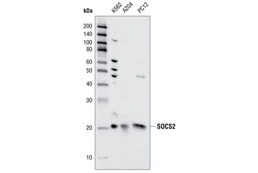 Western blot analysis of extracts from K562, A204 and PC12 cells using SOCS2 Antibody.