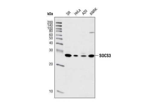 Western blot analysis of extracts from various cell lines using SOCS3 Antibody.