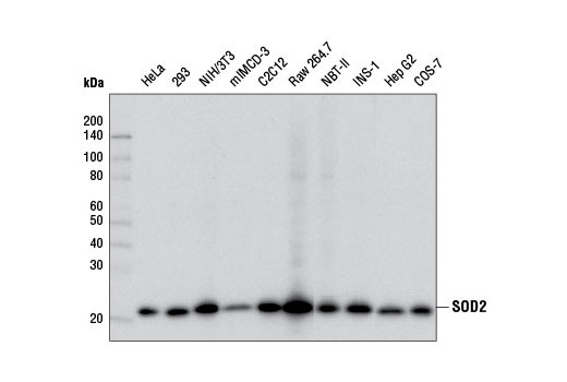 Western blot analysis of extracts from various cell lines using SOD2 (D3X8F) XP ® Rabbit mAb.