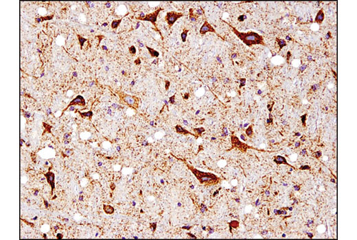 Immunohistochemical analysis of paraffin-embedded normal mouse brain using SOD2 (D3X8F) XP ® Rabbit mAb.