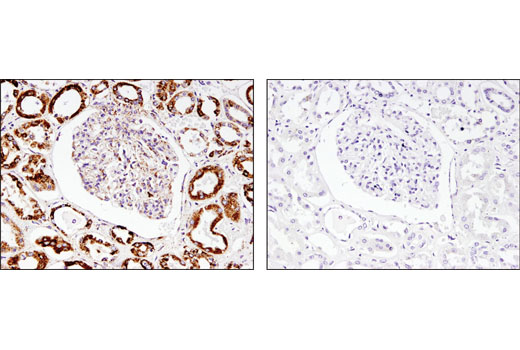 Immunohistochemical analysis of paraffin-embedded human kidney using SOD2 (D3X8F) XP ® Rabbit mAb in the presence of control peptide (left) or antigen-specific peptide (right).