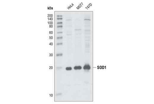 Western blot analysis of extracts from HeLa, MCF7 and T47D cell lines, using SOD1 Antibody.