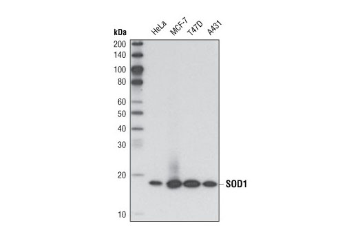 Western blot analysis of extracts from various cell lines using SOD1 (71G8) Mouse mAb.