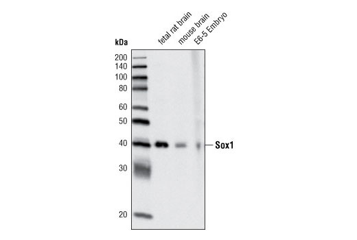 Western blot analysis of extracts of fetal rat brain, mouse brain and E6-5 embryo, using Sox1 Antibody.